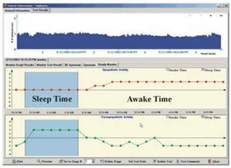 Quality of Sleep